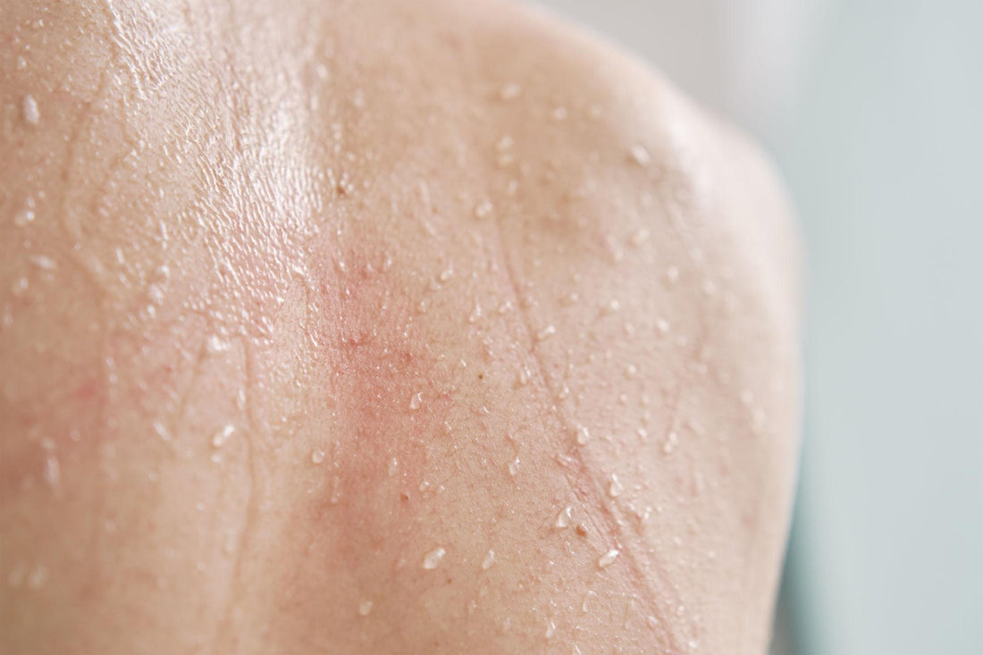 Your Skin’s Invisible Enemy: What’s Really in Your Water