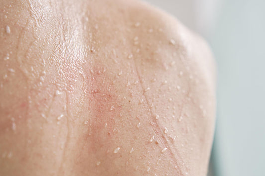 Your Skin’s Invisible Enemy: What’s Really in Your Water